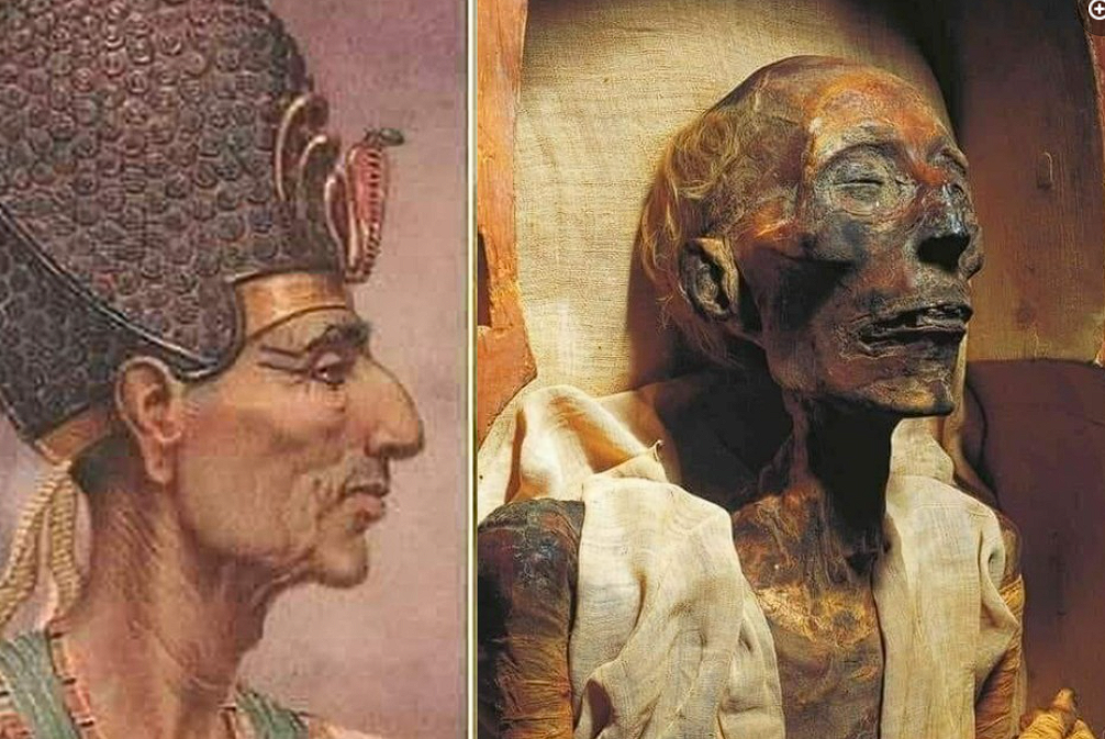 Ramses II: The Legendary Pharaoh of Ancient Egypt